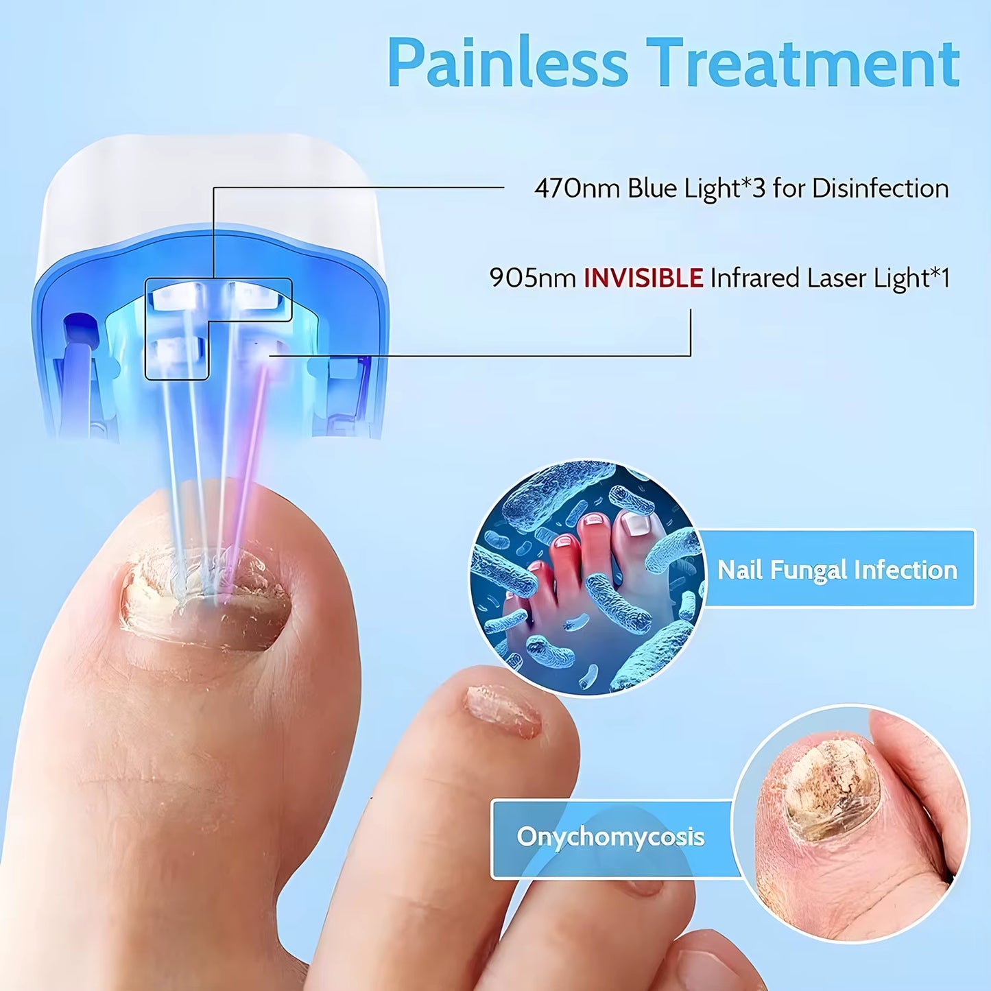 1Pcs Effective Rechargeable Nail Fungus Remover Nail Fungus Cleaning Laser Device Repair Damaged Discolored Thick Fingernails