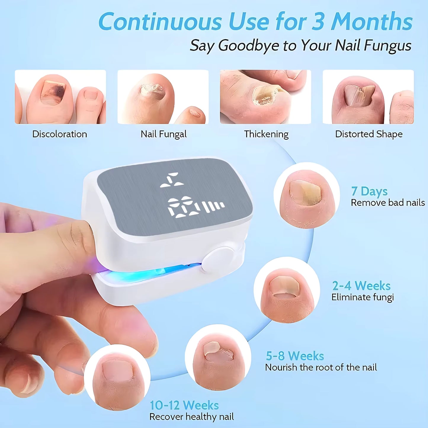 LumiNail™ - Nail Rejuvination Device