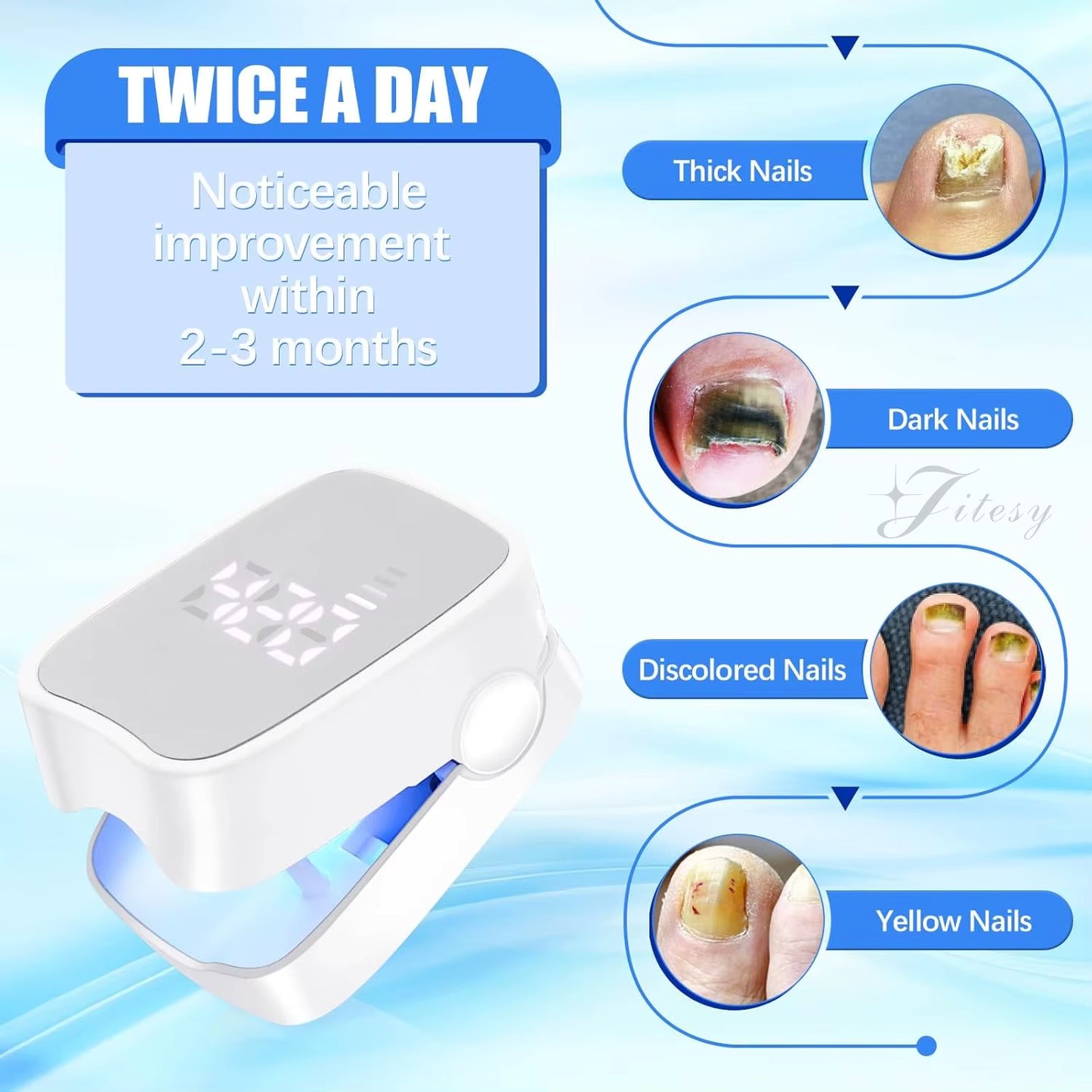 LumiNail™ - Nail Rejuvination Device