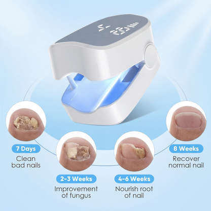 LumiNail™ - Nail Rejuvination Device
